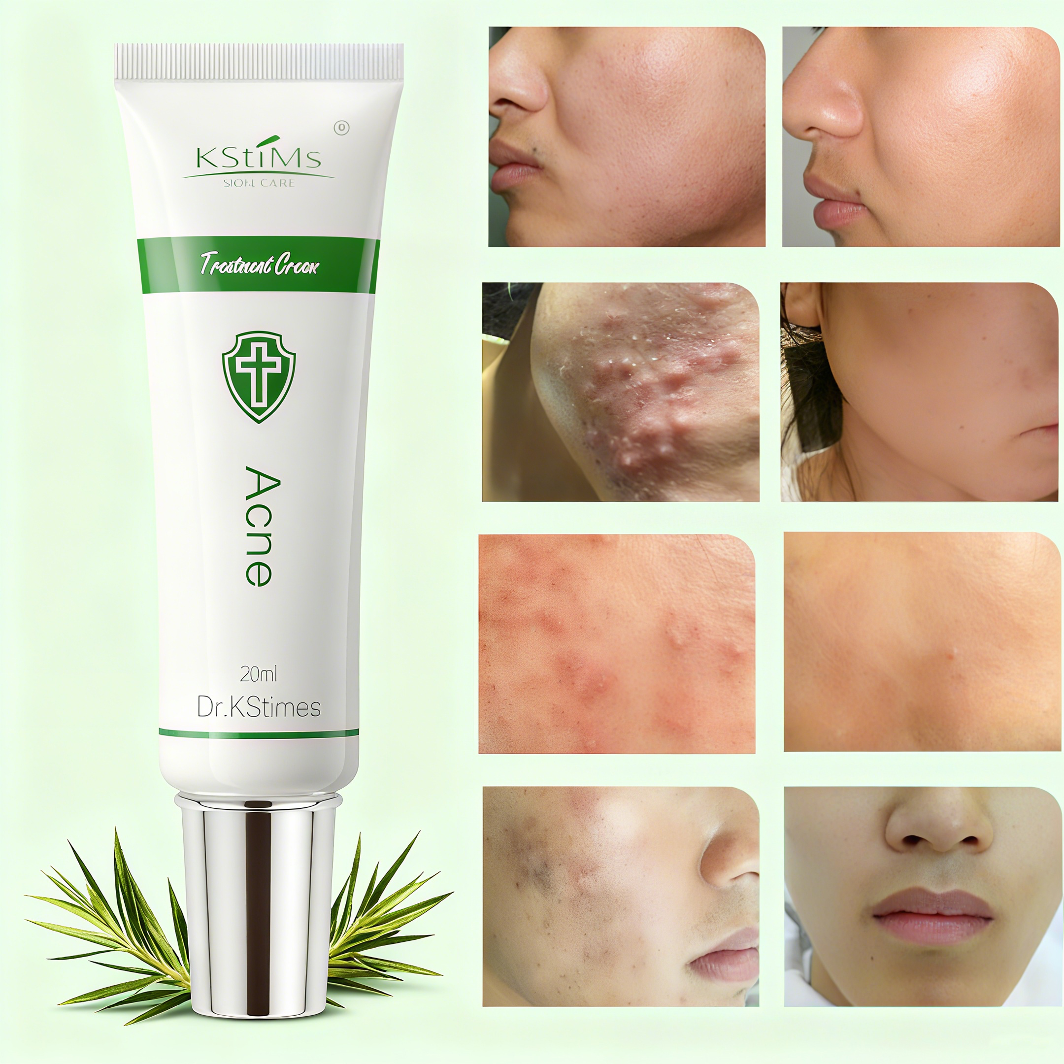 Tea Tree Spot Treatment - Acne Treatment Face Cream Acne Spot
