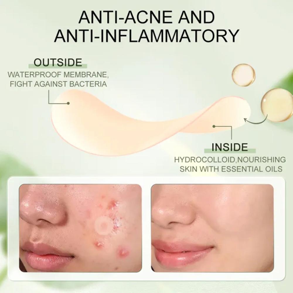 Acne Pimple Patches (30 Count) - Tea Tree Spot Treatment avis et prix