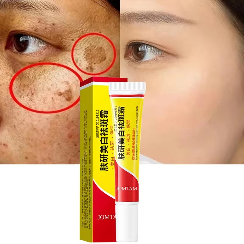 Whitening Freckle Cream Face B - Skincare Glad2Glow avis et prix