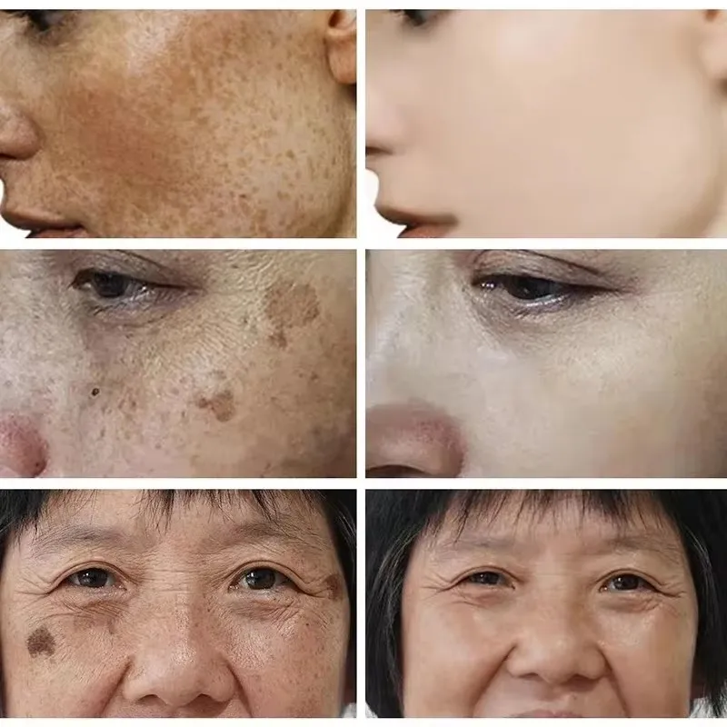 Whitening Freckle Cream Face B - Skincare Glad2Glow avis et prix