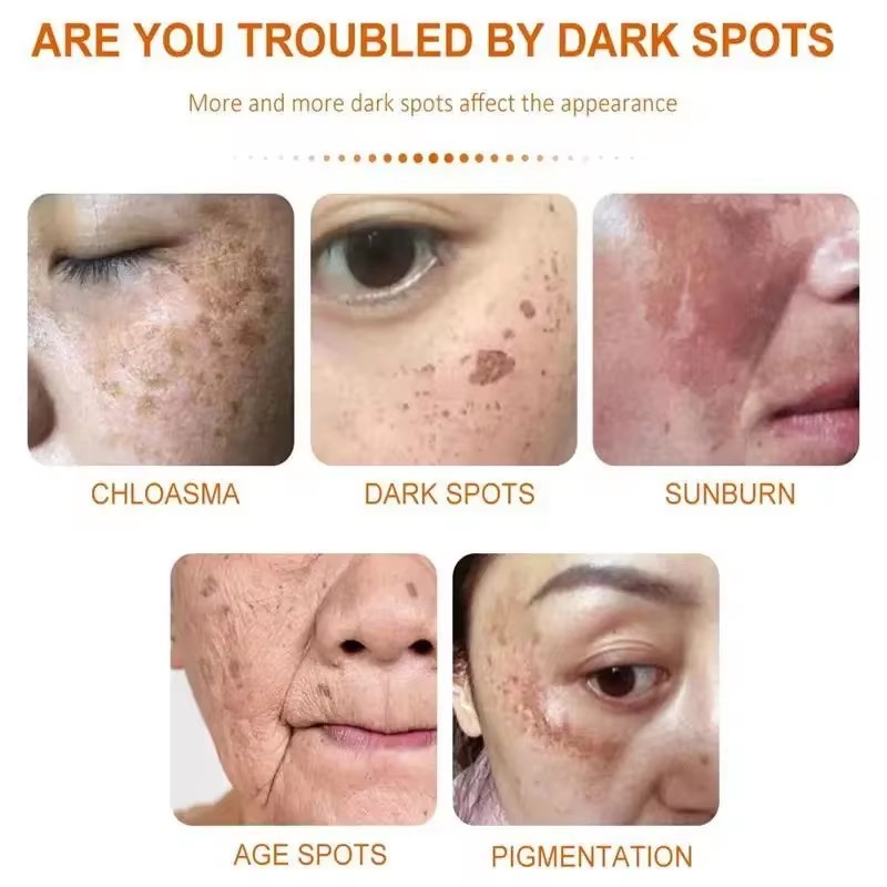 Whitening Freckle Cream Face B - Skincare Glad2Glow avis et prix