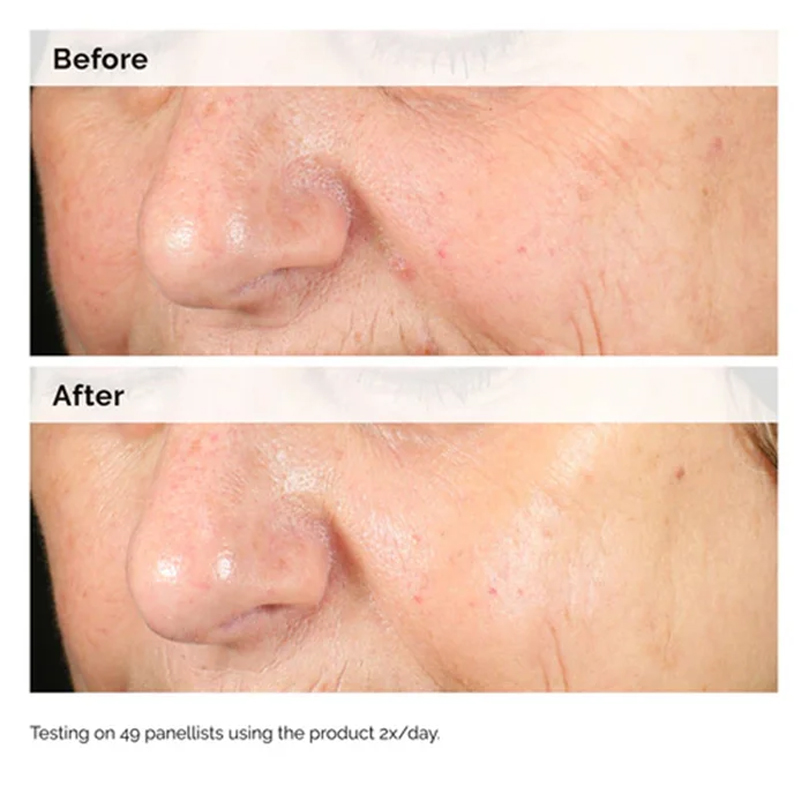 Alpha Arbutin 2% + HA 30ml Ser - Alpha Arbutin Serum avis et prix