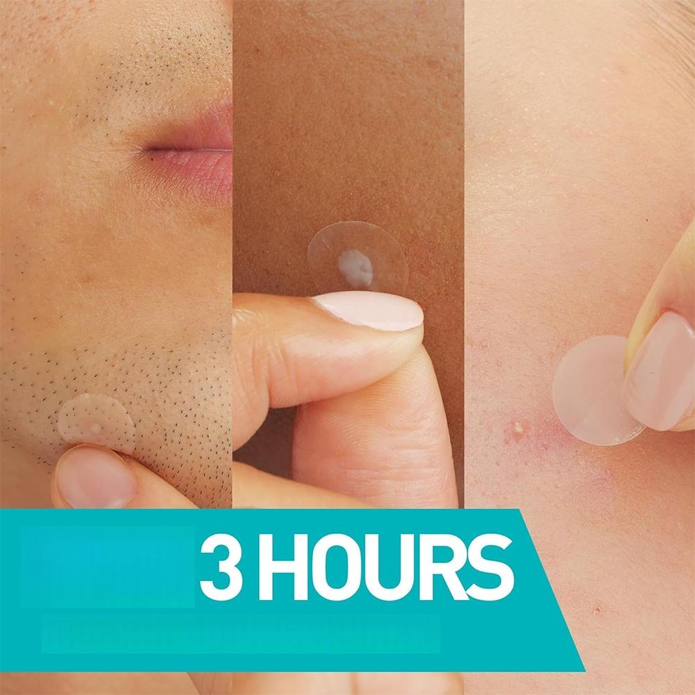 Invisible Pimple Patch 24/200/ - Skincare Moisturizer avis et prix