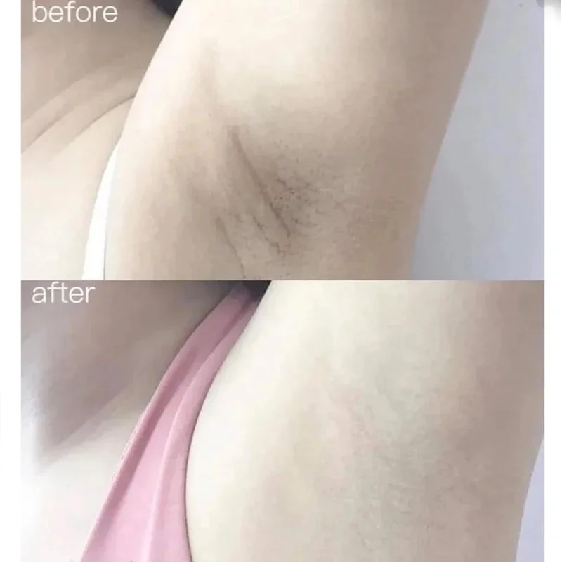 100ml Alpha Arbutin Collagen W - Alpha Arbutin Serum avis et prix