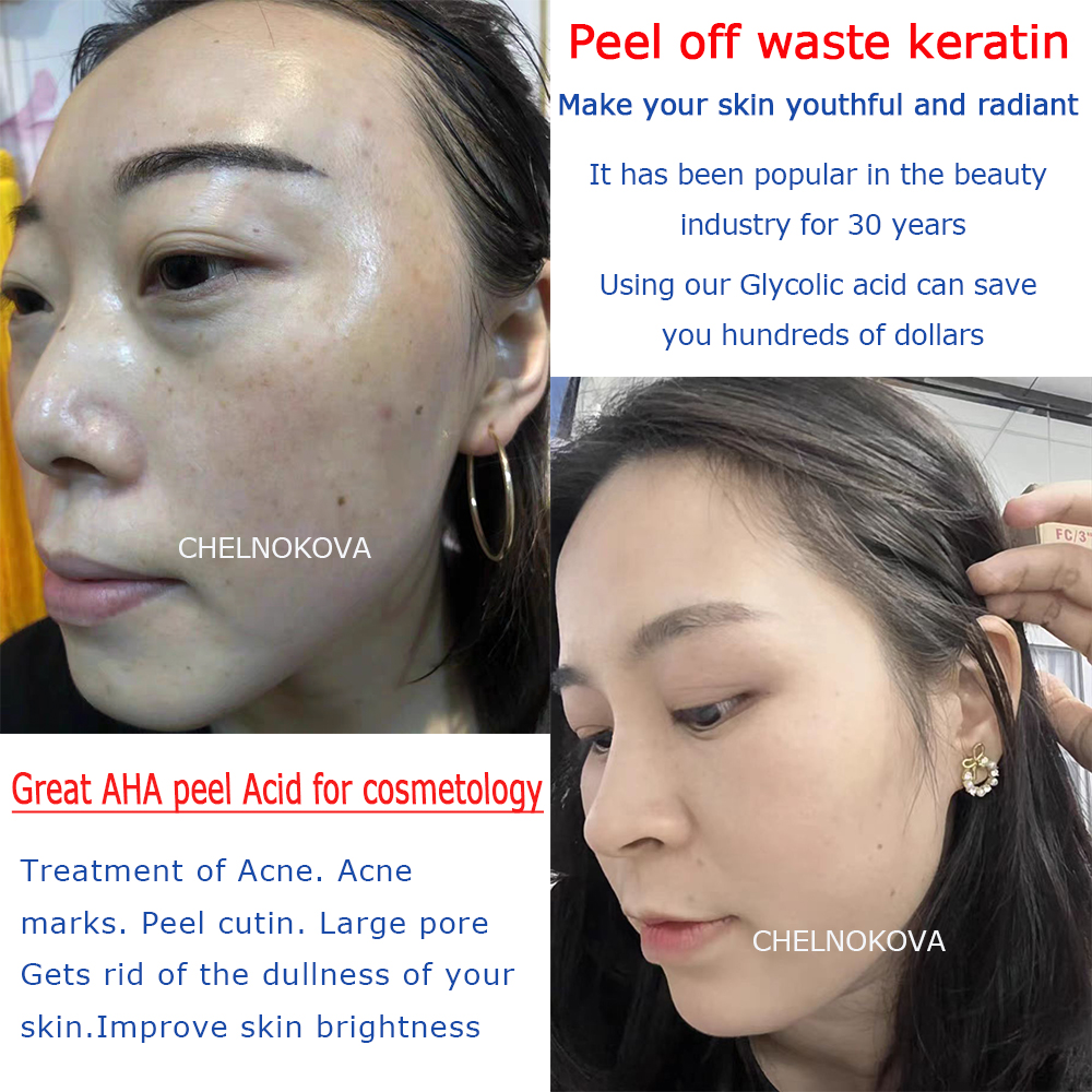 Citric acid 20% 30% 40% 50% pe - Skincare Basic avis et prix