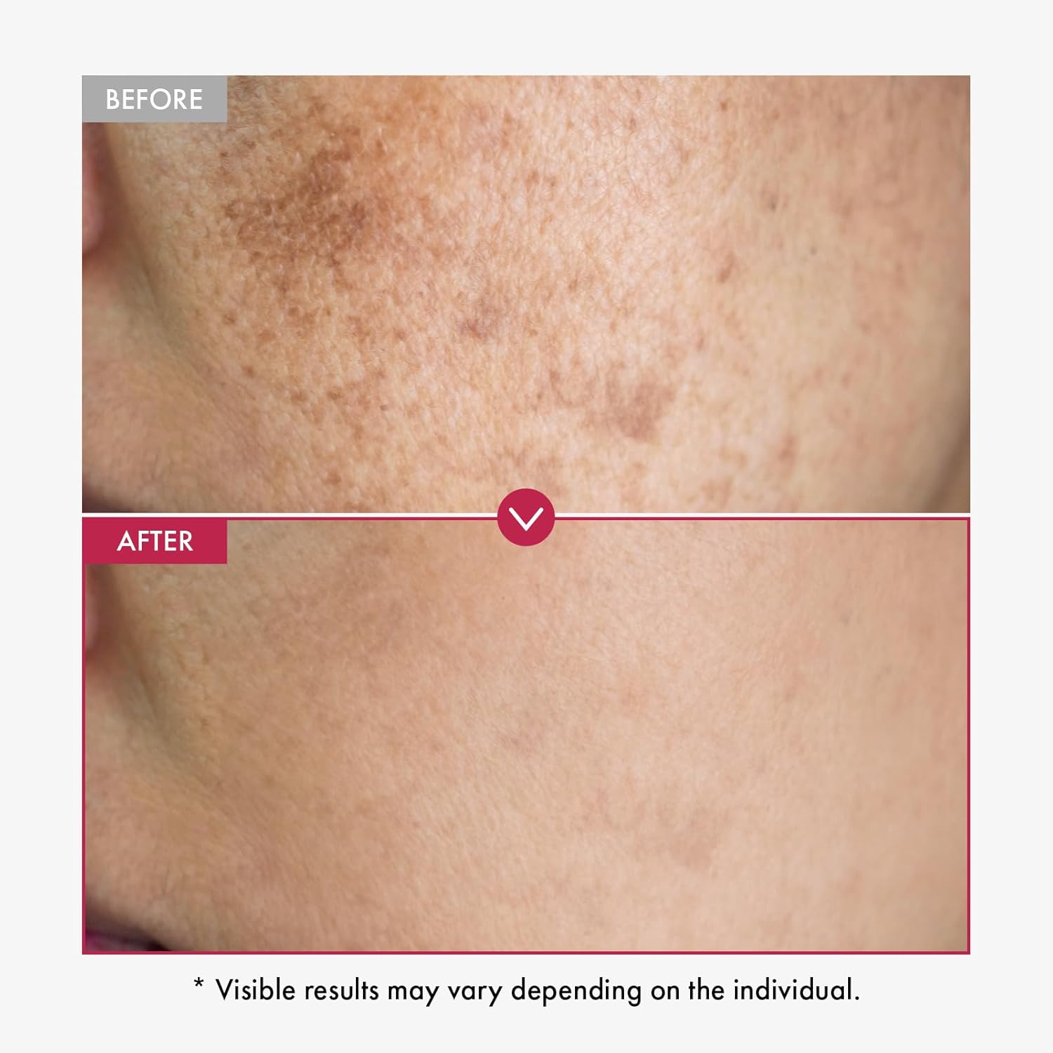 Alpha Arbutin Serum AHA Keeps  - Alpha Arbutin Serum avis et prix