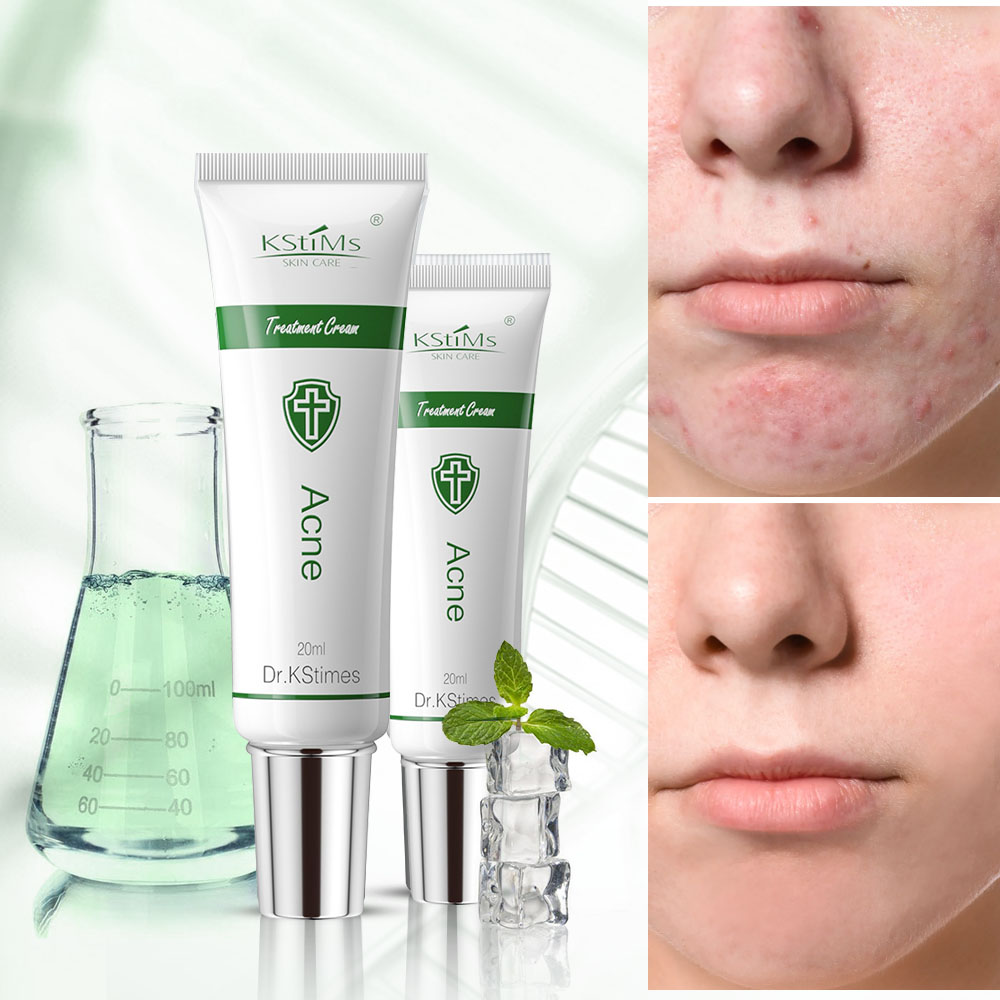 Acne Treatment Face Cream Acne - Tea Tree Spot Treatment avis et prix