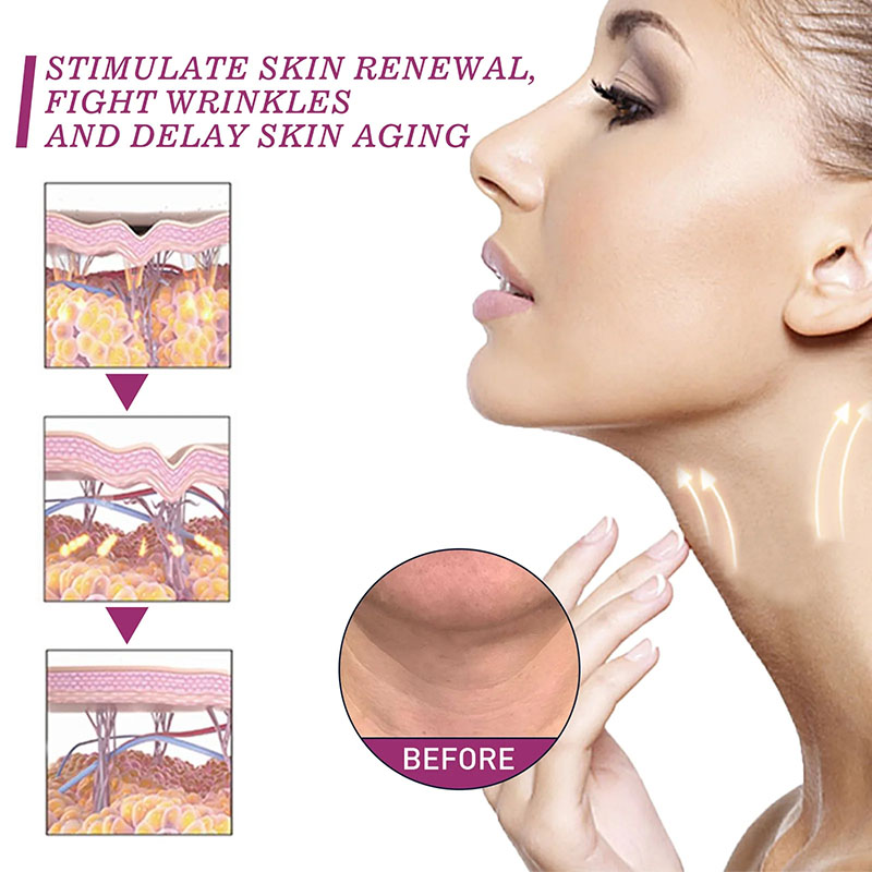 Roller Neck Cream Smooth Wrink - Retinol Vitamin A Cream avis et prix