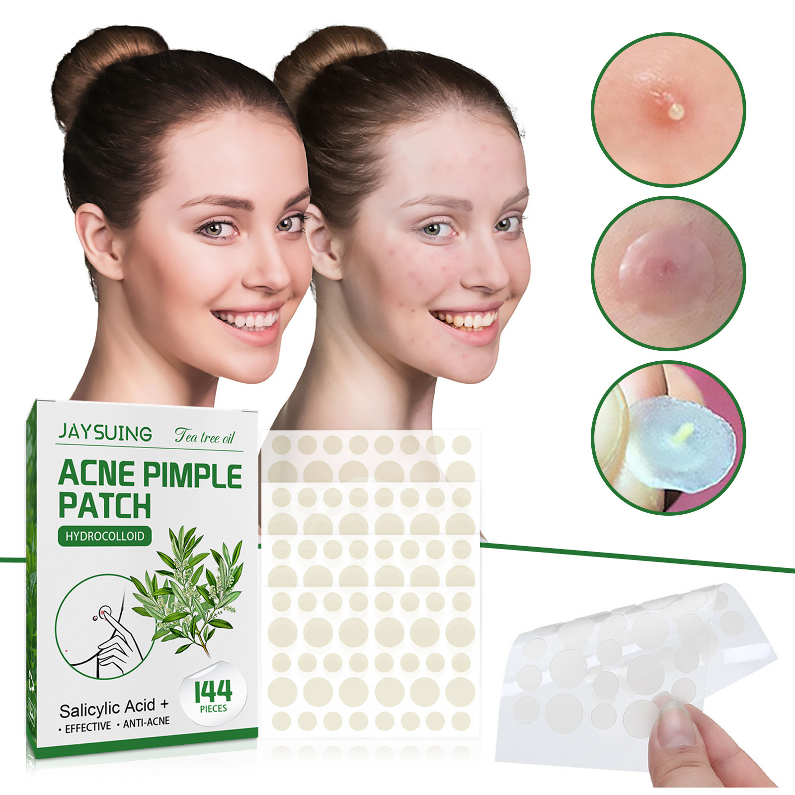 Hydrocolloid Acne Patches - Ab - Skincare Moisturizer avis et prix