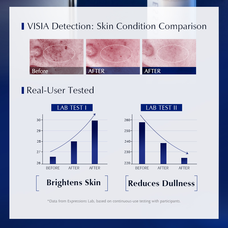 Niacinamide + Alpha Arbutin Fa - Alpha Arbutin Serum avis et prix
