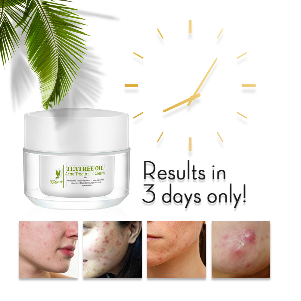 KStims Natural Acne Treatment  - Tea Tree Spot Treatment avis et prix