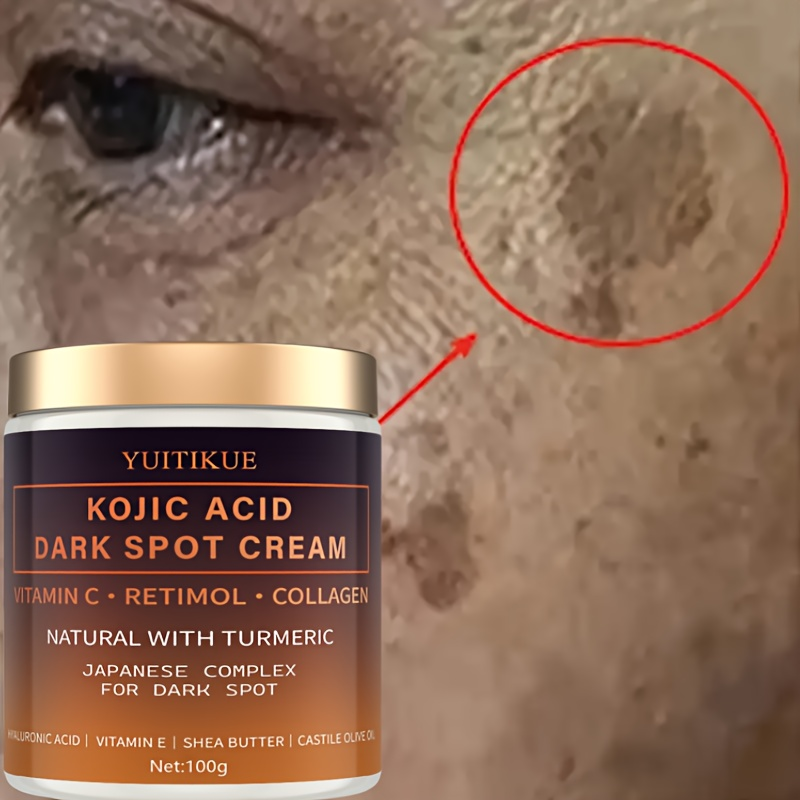 Arbutin fading cream, Vitamin  - Retinol Vitamin A Cream avis et prix