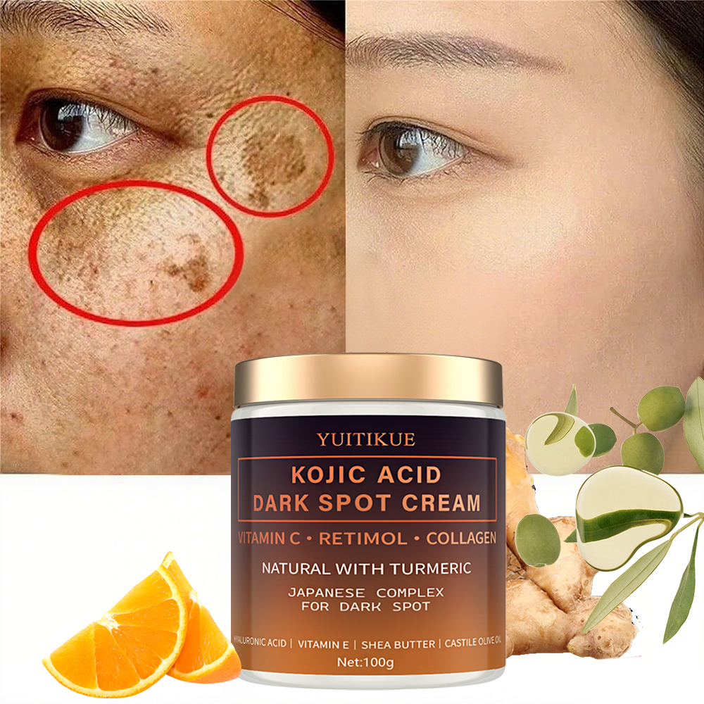 Arbutin fading cream, Vitamin  - Retinol Vitamin A Cream avis et prix